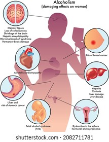 Anatomical Examination Of The Positive And Negative Effects Of Alcohol On The Human Body Biological Disease Liver Enzymes 2