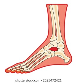 An anatomical illustration of the human foot skeleton, showcasing the bones in a detailed and isolated view on a white background.