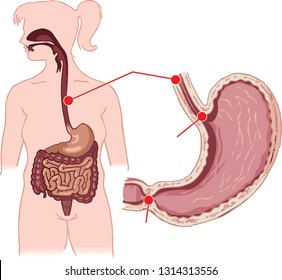 Anatomical illustration showing the stomach