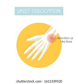 Anatomical vector illustration in a flat style of wrist dislocation. Sport injuries, arm treatment