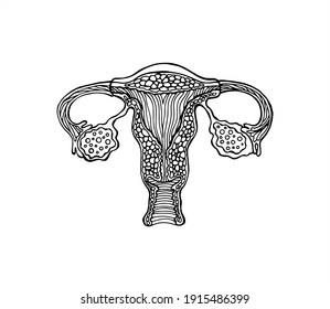 Genitales femeninos dibujados anatómicamente correctos. Utero, vagina, huevos y endometrio. Ilustración para el estudio del síndrome premenstrual, anticoncepción, ovulación, menopausia y embarazo
