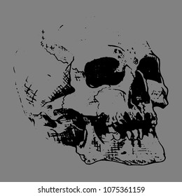 Anatomically damaged skull. Head, skeleton, jaw. Sketch