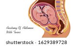 Anatomy of abdomen with twins. Pregnancy women diagrams 