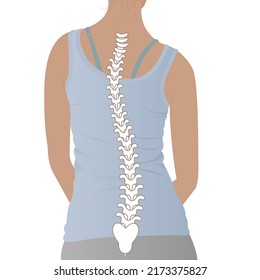 Anatomy of curvature of the spine in scoliosis, posture correction. Chiropractic Treatment, back pain relief