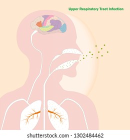 Anatomy drawing and Respiratory Tract Diseases. Upper Respiratory Tract Infection. Allergy. Vector illustration, no transparency, no gradients.