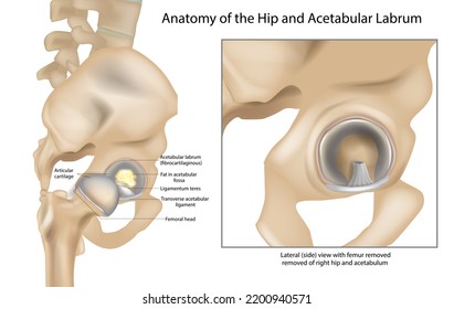 Anatomy of the Hip and Acetabular Labrum. Ligamentum teres and Articular cartilage. Lateral view with femur  of right hip.