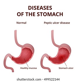 Anatomy Human Stomach Medical Poster Detailed Stock Vector (Royalty ...