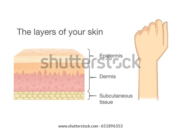 Anatomy Human Skin Layer Arm Isolated Stock Vector (Royalty Free) 651896353