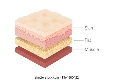 Anatomy Of Human Skin Layer, Fat And Muscle Layer In Isometric Style. Illustration About Medical And Health.