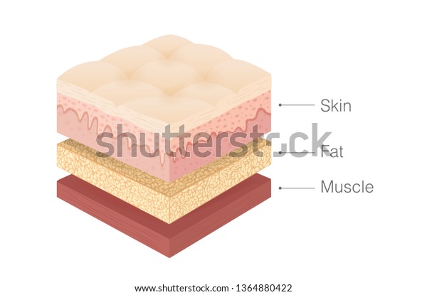 人間の皮膚層 等角投影法の脂肪層 筋肉層の構造 医療と健康に関するイラスト のベクター画像素材 ロイヤリティフリー