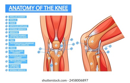 Anatomía De La Articulación De La Rodilla Infografías Médicas. Patela, Fémur, Cartílago Articular. Menisco Externo O Interno, Tibia