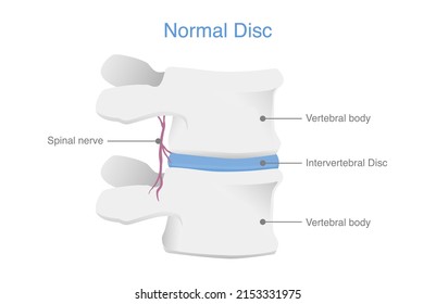 Anatomy Of Normal Human Disc. Illustration Of Medical Diagram About The Spine In Top View For Check Disc Herniation. Nucleus Pulposus, Annulus Fibrosis.