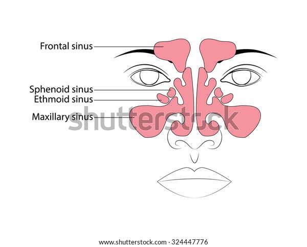 Anatomy of the\
paranasal sinuses.\
Sinusitis.