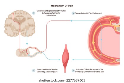 Anatomía y fisiología del dolor. Reacción del SNC o reflejo sobre estimulación dolorosa. Esquema científico de neurología. Ilustración vectorial plana