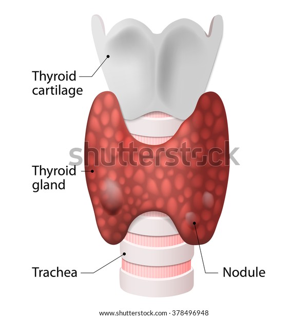甲状腺解剖 包括喉咙 甲状腺和气管 库存矢量图 免版税