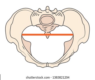 Android Pelvis Shape w Triangular or Heart shape