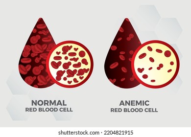 1,114 Red Blood Cell And Iron Images, Stock Photos & Vectors | Shutterstock