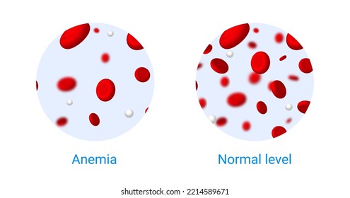 Anemia Problem Circulatory Iron Body Diagram Background. Anaemia Biology Blood Isolated Medical Normal Icon