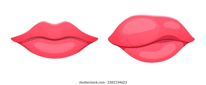 Angioedema or edema of lips. Body tissue swelling, allergic syndrome, dermatology edema disease or infection inflammation symptom, healthcare or medical problem concept with woman cartoon vector lips svg