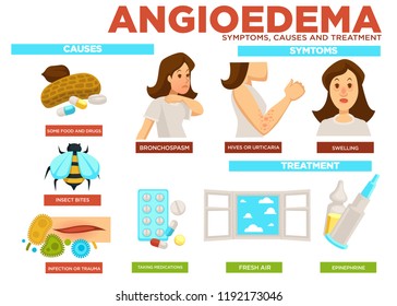 Angioedema symptom, causes and treatment of disease vector svg