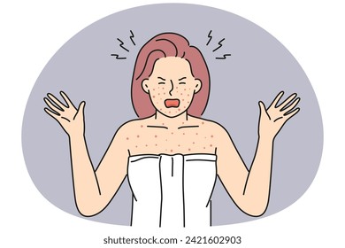 Angry woman in towel shout distressed with red body inflammation. Furious female anxious with allergy reaction or dermatitis. Vector illustration.