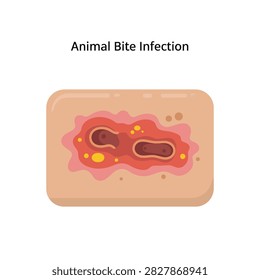 Animal bite infection wound featuring inflamed skin lesion and bacterial activity for medical education and first aid training