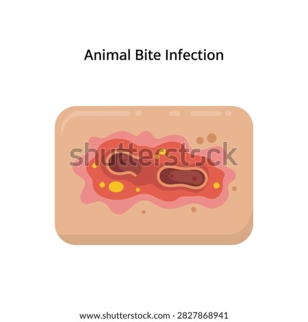 Animal bite infection wound featuring inflamed skin lesion and bacterial activity for medical education and first aid training