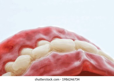 Animation Denture. Characterise Denture. Dental Animation