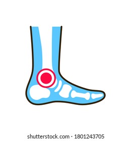 Ankle arthritis line color icon. Inflammation joint. Sign for web page, mobile app, button, logo. Editable stroke.