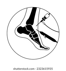 Ankle arthroscopy procedure. Feet joint minimally invasive surgery concept. Arthroscope and arthroscopic instrument. Foot treatment, leg pain and inflammation. Anatomical x ray vector illustration