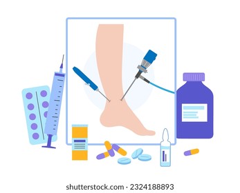 Ankle arthroscopy procedure. Feet joint minimally invasive surgery concept. Arthroscope and arthroscopic instrument. Foot treatment, leg pain and inflammation. Patient in clinic vector illustration