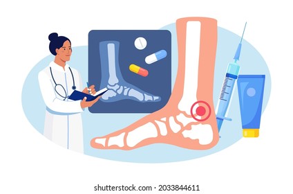 Ankle Foot Arthritis. Doctor Examining Xray Pictures Of Joints. Osteoarthritis, Rheumatoid Arthritis, Rheumatism Disease. Physician Treat Patient Joint Pain. Vector Illustration