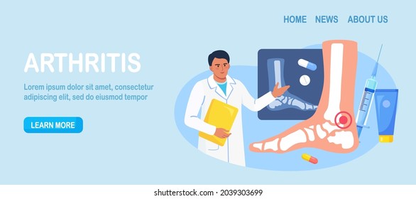 Ankle Foot Arthritis. Doctor Examining Xray Pictures Of Joints. Osteoarthritis, Rheumatoid Arthritis, Rheumatism Disease. Physician Treat Patient Joint Pain. Vector Illustration