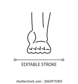 Ankle Inflammation Linear Icon. Swollen Foot And Ankle. Osteoarthritis Development. Tendonitis. Thin Line Customizable Illustration. Contour Symbol. Vector Isolated Outline Drawing. Editable Stroke