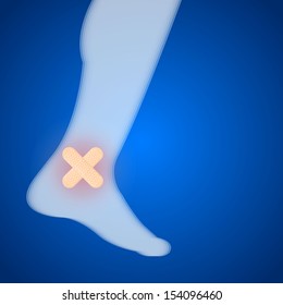 Ankle injuries on a blue background. Illustration.