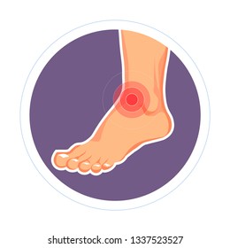 Ankle injury trauma leg joint dislocation vector isolated icon medicine and healthcare traumatology skeletal disease pain swelling bone damage treatment inflammation arthritis muscle stretching