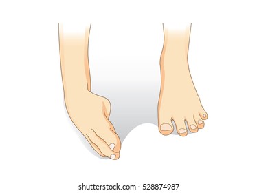 Ankle sprain while walking. Illustration about medical and good foot care.