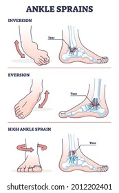 ankle inversion