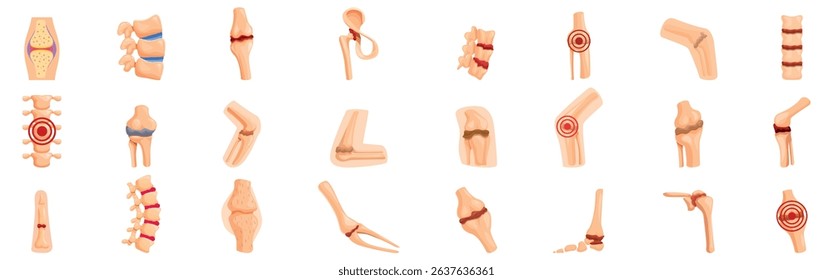 Ankylosis icons set. Medical infographic showing different body parts affected by joint pain, arthritis, and bone disease