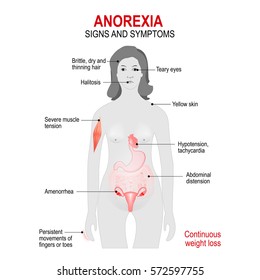 What are the effects of anorexia nervosa