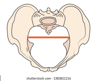 Anthrepoid Pelvis Shape w Round or Oval shape