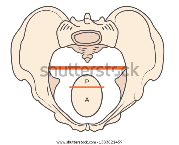 Antropoide