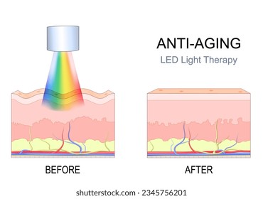 tratamiento antiedad de la luz LED. Cruzar la piel humana con arrugas antes del procedimiento y la piel hermosa después de la terapia de rejuvenecimiento. tratamiento facial en el complejo SPA. Ilustración del vector