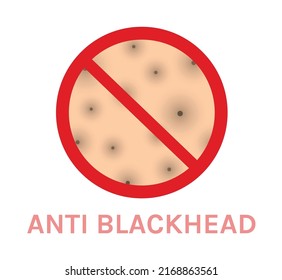 Anti Blackheads. Sign of Prohibition and Black Dots on Human Skin. Isolated Symbol of Problem Skin. Zoom. Color Realistic style. White background. Vector illustration for Beauty and Cosmetology Design