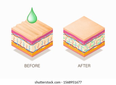 Anti-aging concept with before and after beauty treatment. Good example of how it works cosmetic filler or Dermal fillers as a cream or injection. Vector illustration skin structure.