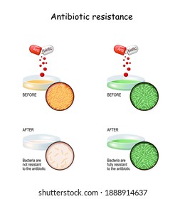Antibiotic resistance. Experiment with two Petri dish, and bacteria. comparison colonies of bacteria Before and after Antibiotic therapy. infectious disease