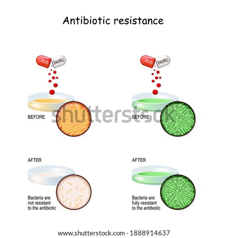 Antibiotic resistance. Experiment with two Petri dish, and bacteria. comparison colonies of bacteria Before and after Antibiotic therapy. infectious disease