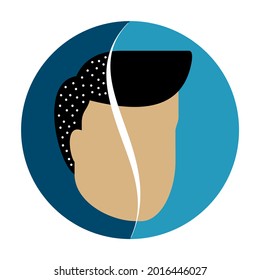 Anti-dandfurr Formula Icon - Half Head With Dandruff Flakes And Half Without - After Shampoo Using. Vector Illustration