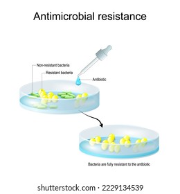 Antimicrobial resistance. Non-resistant and Resistant bacteria. colonies of bacteria Before and after Antibiotic therapy. Pipette with drop of antibiotic, and petri dish with colony of bacteria