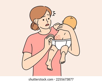 Anxious young mother confused with newborn baby body rash. Worried mom scared about child infant skin allergy. Motherhood, infantry healthcare. Vector illustration. 